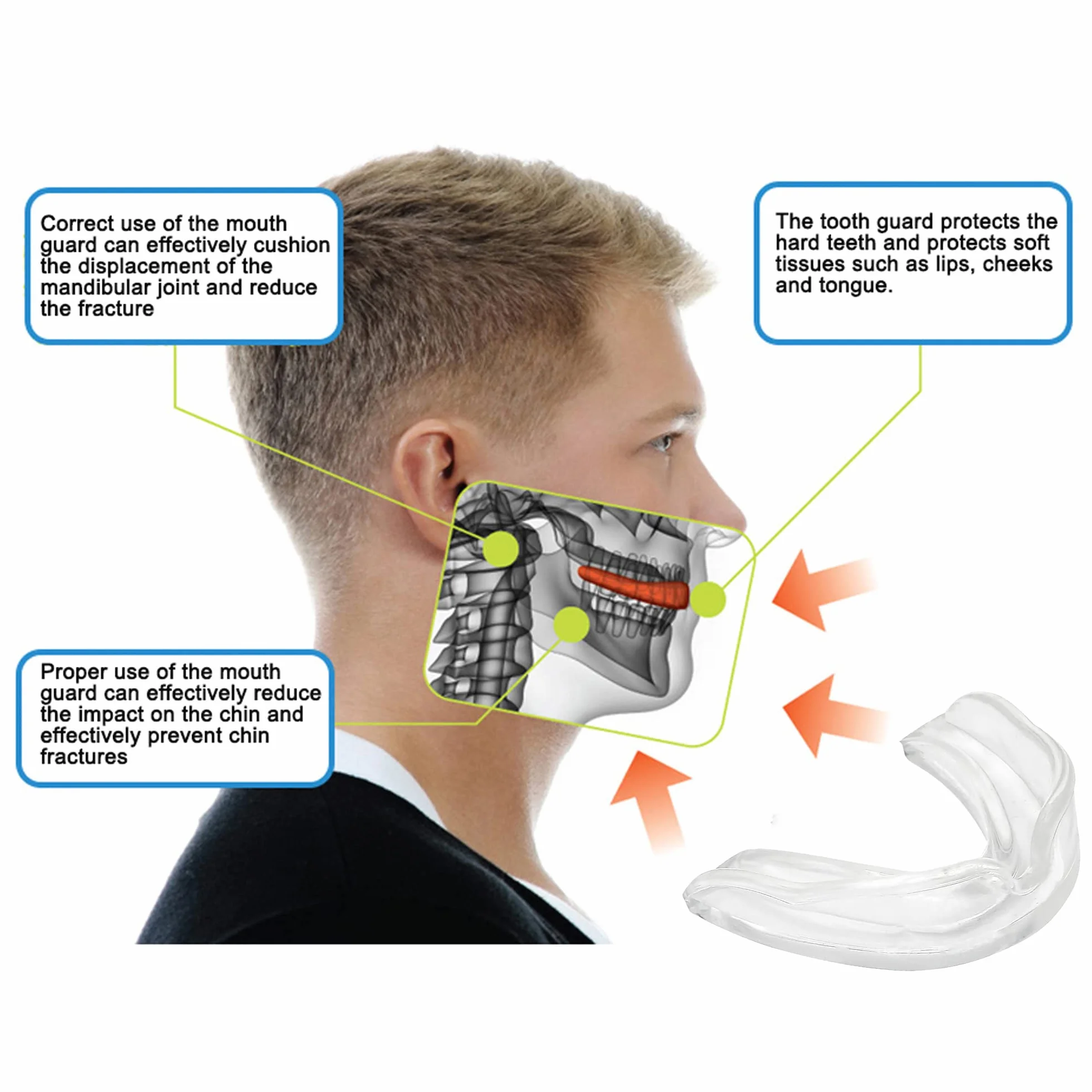 Protège-dents professionnel sports de contact rugby arts martiaux MMA boxe hockey football Flexible adultes transparent