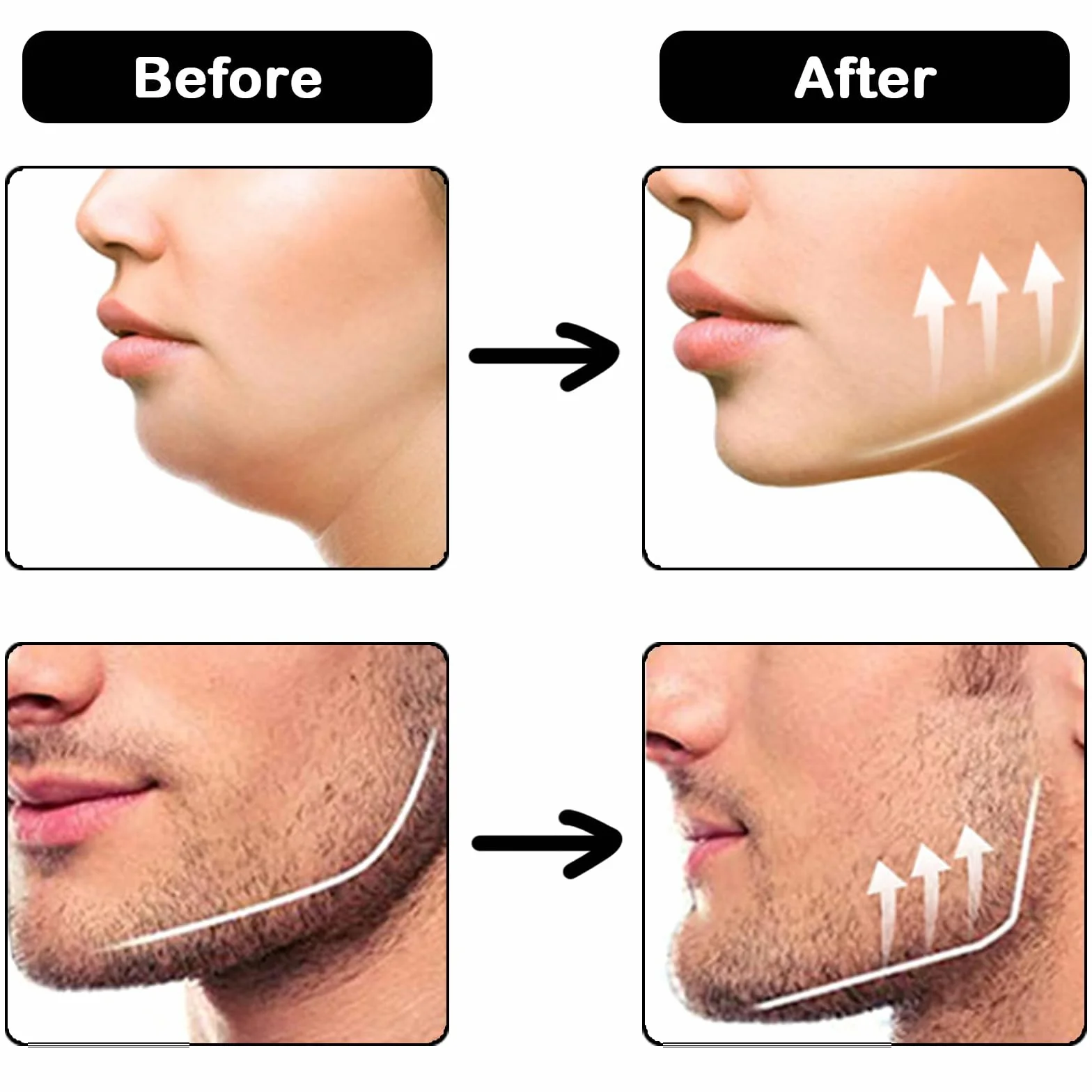 Jaw Trainer Silicone Gomme Musculation Machoire 6 Pièces Hommes Femmes