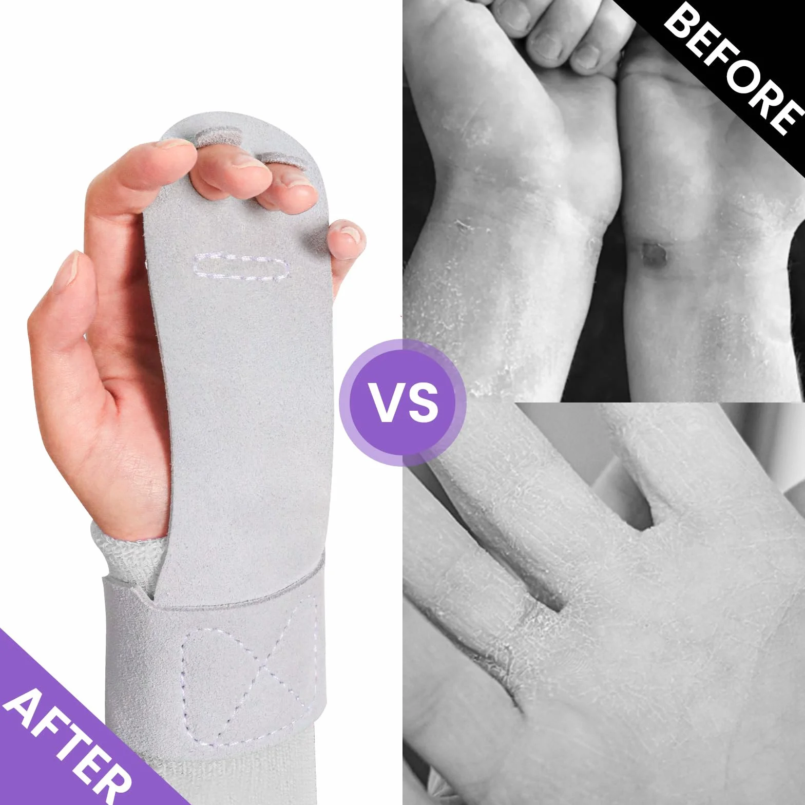 FINGER TEN Poignées de gymnastique en cuir à double boucle pour barres filles femmes avec bracelets support poignet entraînement haltérophilie